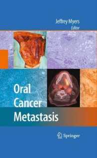 Oral Cancer Metastasis （2010）