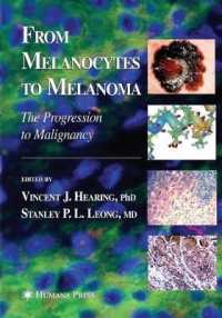 From Melanocytes to Melanoma : The Progression to Malignancy