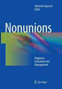 Nonunions : Diagnosis, Evaluation and Management