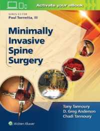 Minimally Invasive Spine Surgery