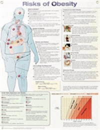 Risks of Obesity Anatomical Chart Laminated （2ND）