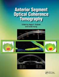 前眼部OCT検査<br>Anterior Segment Optical Coherence Tomography
