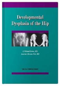 Developmental Dysplasia of the Hip