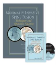 Minimally Invasive Spine Fusion (2-Volume Set) : Techniques and Operative Nuances （HAR/DVD）