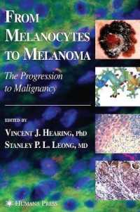 From Melanocytes to Melanoma : The Progression to Malignancy
