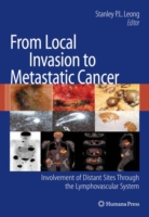 Cancer Metastasis : From Local Proliferation to Distant Sites through the Lymphovascular System (Current Clinical Oncology)