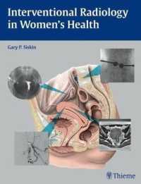 女性のインターベンショナルラジオロジー<br>Interventional Radiology in Women's Health