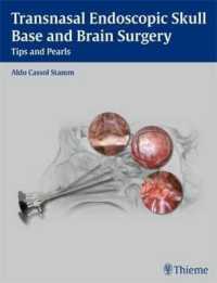 経鼻内視鏡頭蓋底外科<br>Transnasal Endoscopic Skull Base and Brain Surgery : Tips and Pearls （1ST）