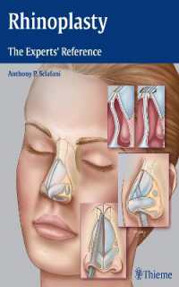 Rhinoplasty : The Experts' Reference
