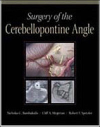 小脳橋角の手術（DVD付）<br>Surgery of the Cerebellopontine Angle （1 HAR/DVD）
