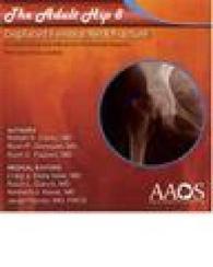 The Adult Hip - 8 Displaced Femoral Neck Fracture （DVD）