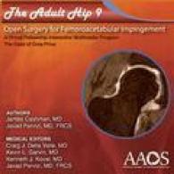 The Adult Hip - Case 9 Open Surgical Treatment of Femoroacetabular Impingement （DVD）