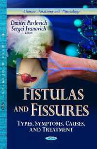Fistulas & Fissures : Types, Symptoms, Causes & Treatment