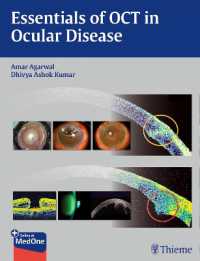 眼疾患のOCT要説<br>Essentials of Oct in Ocular Disease