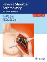 Reverse Shoulder Arthroplasty : A Practical Approach