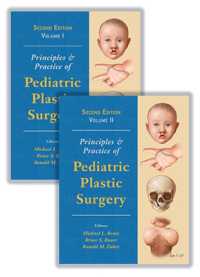 小児形成外科：原理と実際（第２版・全２巻）<br>Principles and Practice of Pediatric Plastic Surgery （2ND）