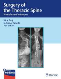 Surgery of the Thoracic Spine : Principles and Techniques