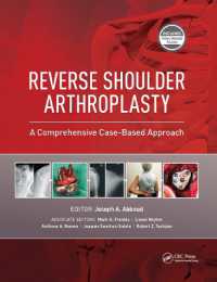 Reverse Shoulder Arthroplasty : A Comprehensive Case-Based Approach