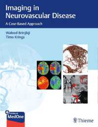 Imaging in Neurovascular Disease : A Case-Based Approach