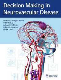 神経血管疾患の意思決定<br>Decision Making in Neurovascular Disease