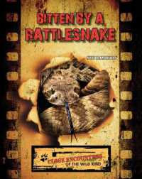 Bitten by a Rattlesnake (Close Encounters of the Wild Kind)