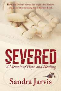 Severed : A Memoir of Hope and Healing