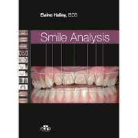 Smile Analysis