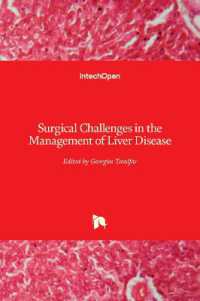Surgical Challenges in the Management of Liver Disease