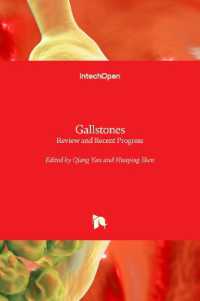 Gallstones : Review and Recent Progress