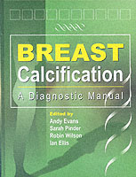 Breast Calcification : A Diagnostic Manual