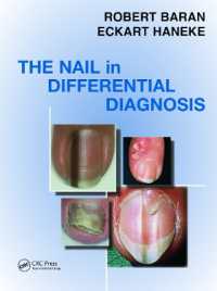爪の疾患の鑑別診断<br>Nail in Differential Diagnosis