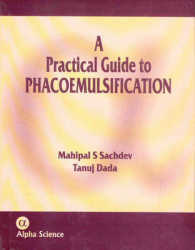 A Practical Guide to Phacoemulsification