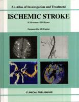 脳梗塞：研究と管理アトラス<br>Ischemic Stroke : An Atlas of Investigation and Diagnosis (Atlas of Diagnosis and Management)