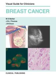 Breast Cancer : Visual Guide for Clinicians