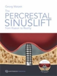 The Percrestal Sinuslift : From Illusion to Reality