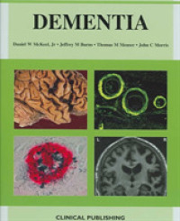 Dementia : An Atlas of Investigation and Diagnosis （1ST）
