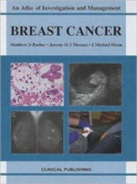 乳癌：研究と管理アトラス<br>Breast Cancer (Atlas of Investigation and Management)