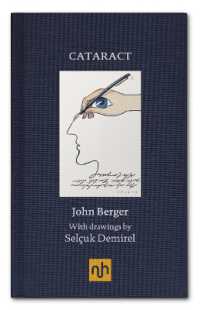 Cataract