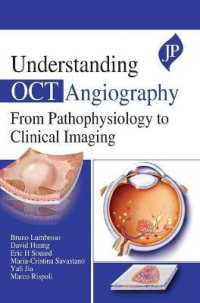 Understanding OCT Angiography : From Pathophysiology to Clinical Imaging