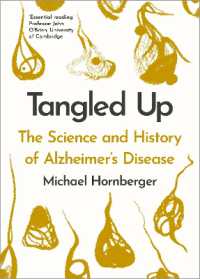 Tangled Up : The History and Science of Alzheimer's Disease