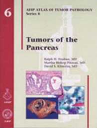 ＡＦＩＰ腫瘍病理学アトラス 第４シリーズ・第６巻：膵臓の腫瘍<br>Atlas of Tumor Pathology, 4th- Fasc. 6 : Tumors of the Pancreas
