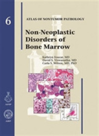 AFIP非腫瘍病理学アトラス　第６巻：骨髄<br>Atlas of Nontumor Pathology Fasc. 6 : Non-Neoplastic Disorders of Bone Marrow