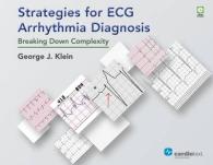 Strategies for ECG Arrhythmia Diagnosis : Breaking Down Complexity