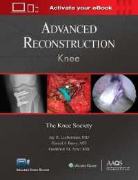 Advanced Reconstruction: Knee: Print + Ebook with Multimedia (Aaos - American Academy of Orthopaedic Surgeons) -- Hardback