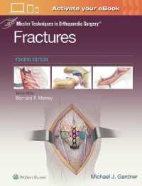 Master Techniques in Orthopaedic Surgery: Fractures (Master Techniques in Orthopaedic Surgery) （4TH）