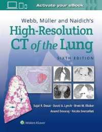 肺の高解像度ＣＴ（第６版）<br>Webb, Müller and Naidich's High-Resolution CT of the Lung （6TH）