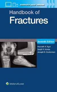 Handbook of Fractures: Print + eBook with Multimedia （7TH）