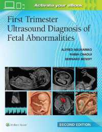 First Trimester Ultrasound Diagnosis of Fetal Abnormalities （2ND）