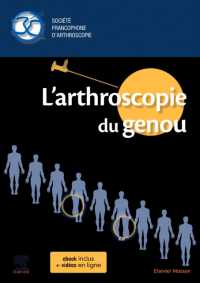 L'ARTHROSCOPIE DU GENOU