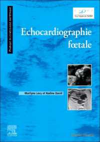 ECHOCARDIOGRAPHIE FOETALE (PRATIQUE EN GYN)